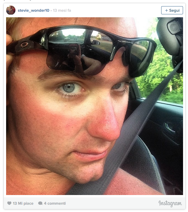 Солнцезащитные очки с переносицей. Солярий. Следы от очков. Следы от очков. Пирсинг переносицы и очки.