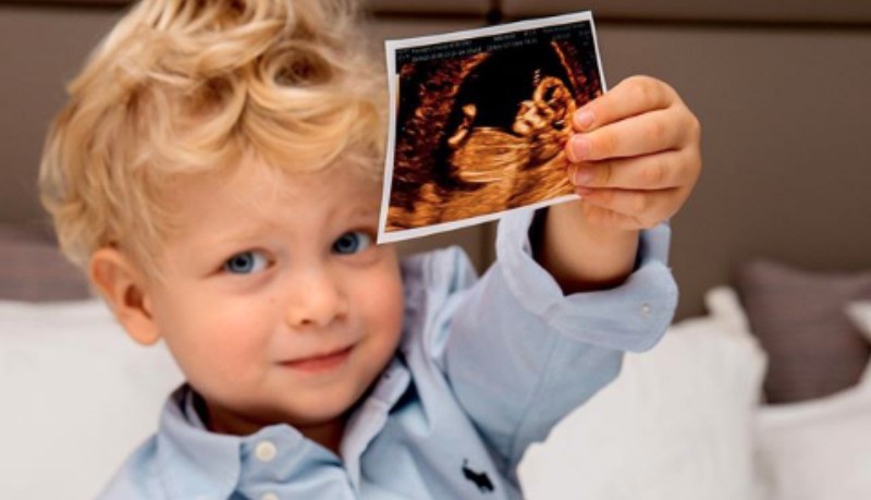 Chiara Ferragni è incinta: la foto di Leone con l’ecografia