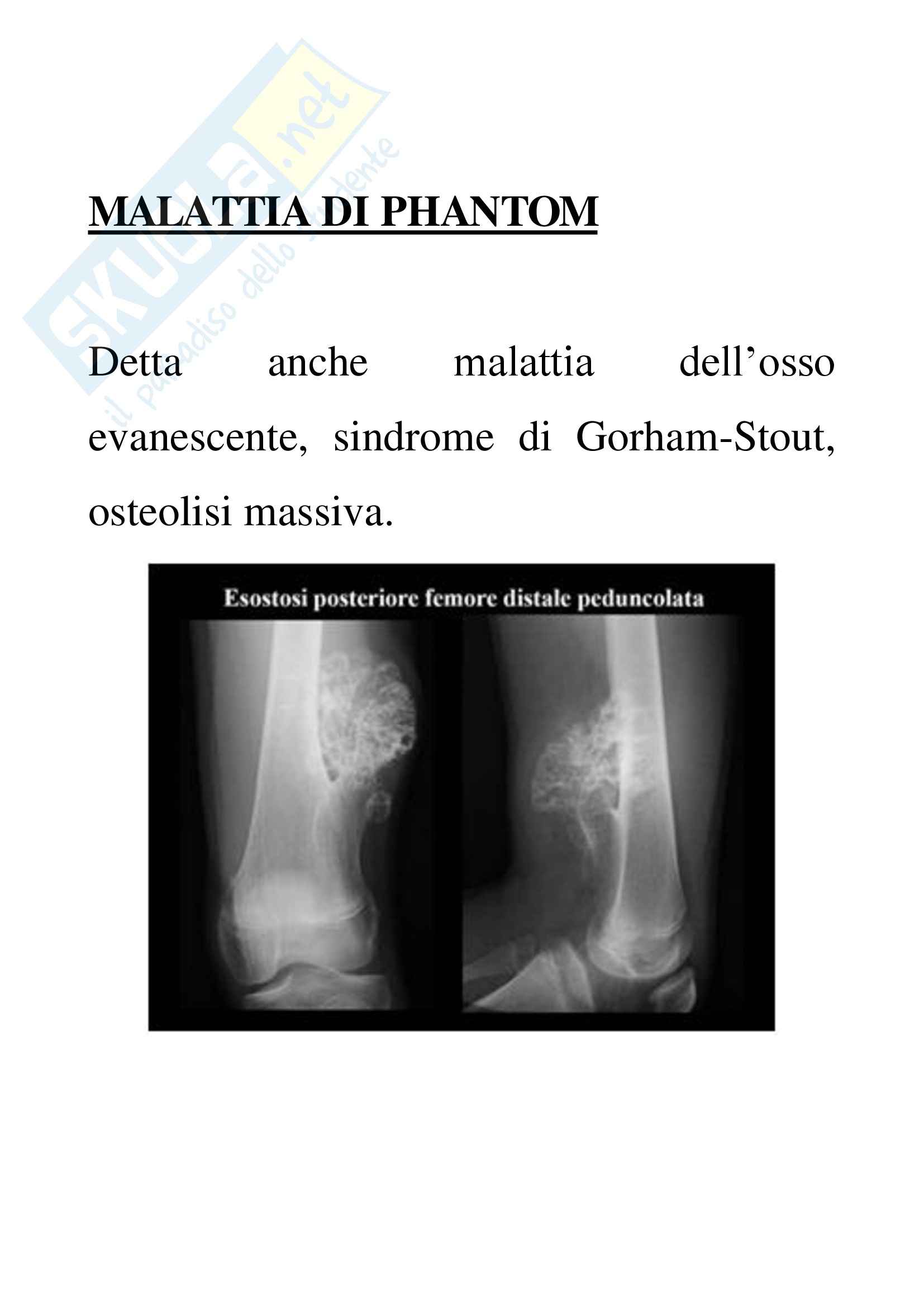 Anatomia patologica - Malattia di Phantom Pag. 1