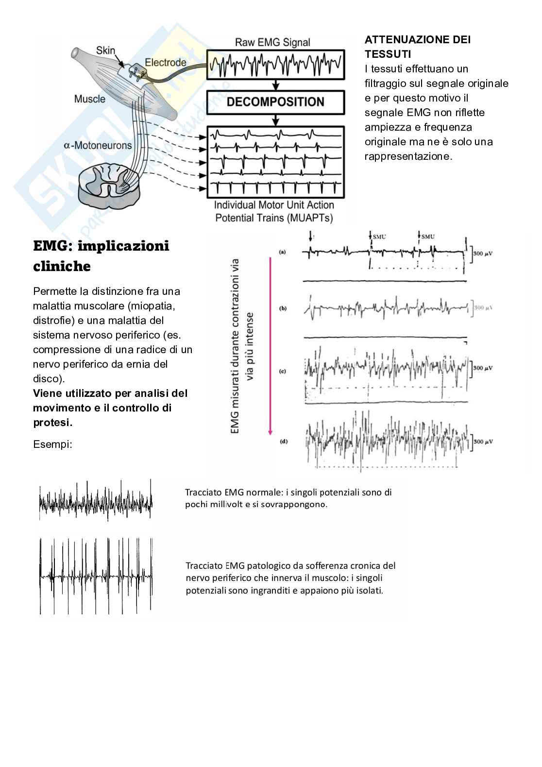 Appunti Elaborazione di segnali biomedici Pag. 11