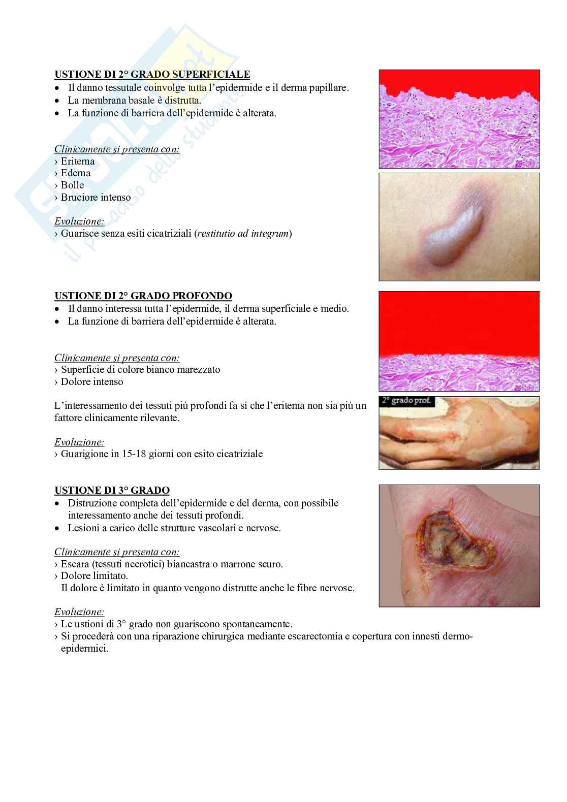 Fisioterapia e professioni sanitarie - Appunti di dermatologia Pag. 26