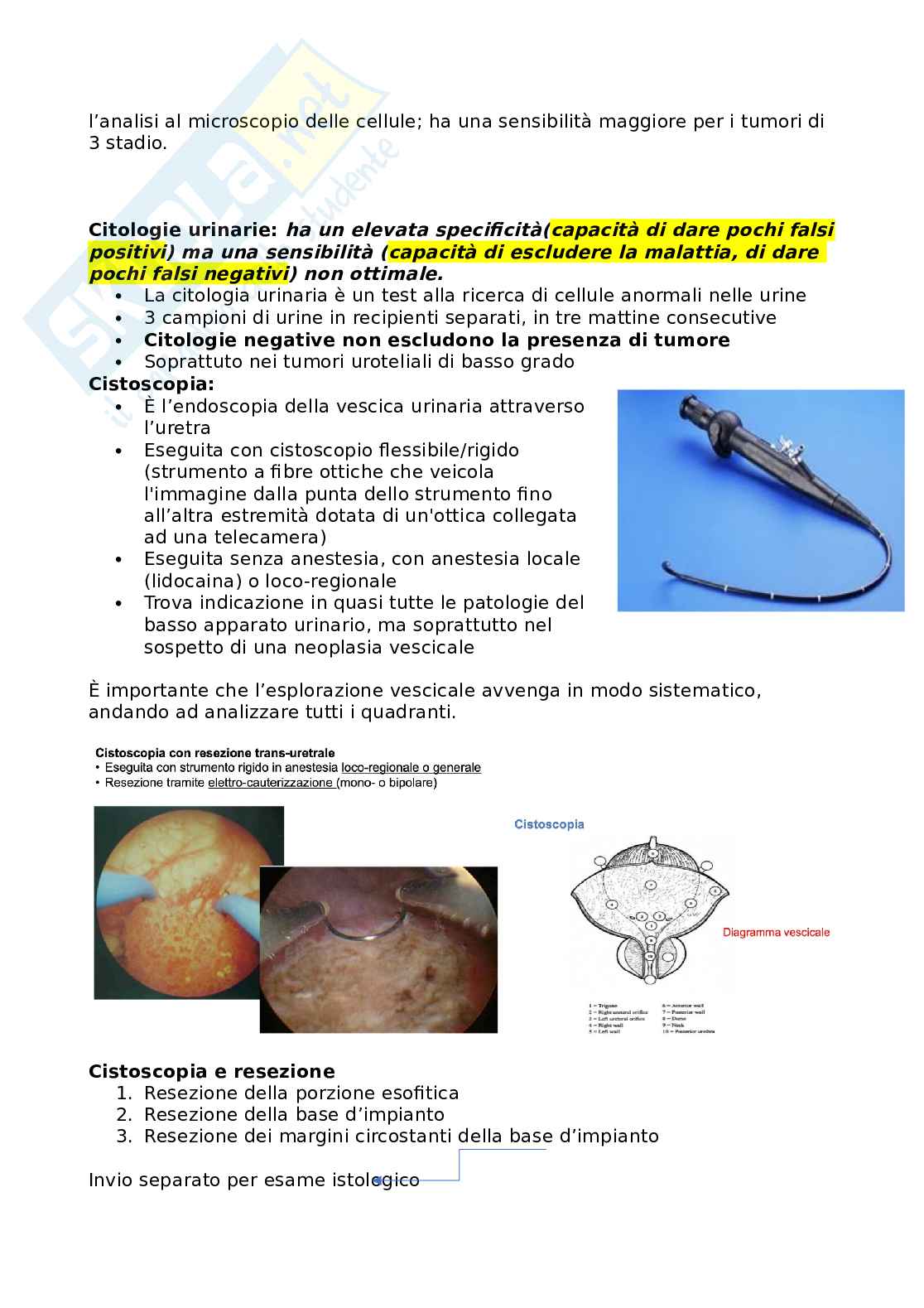 Appunti Chirurgia generale sui tumori alla vescica  Pag. 6