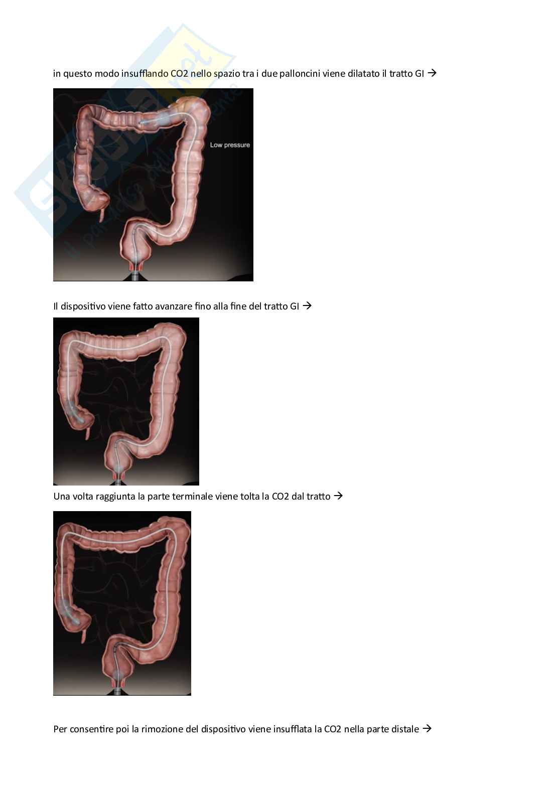 Robotica e simulazione chirurgica  Pag. 16
