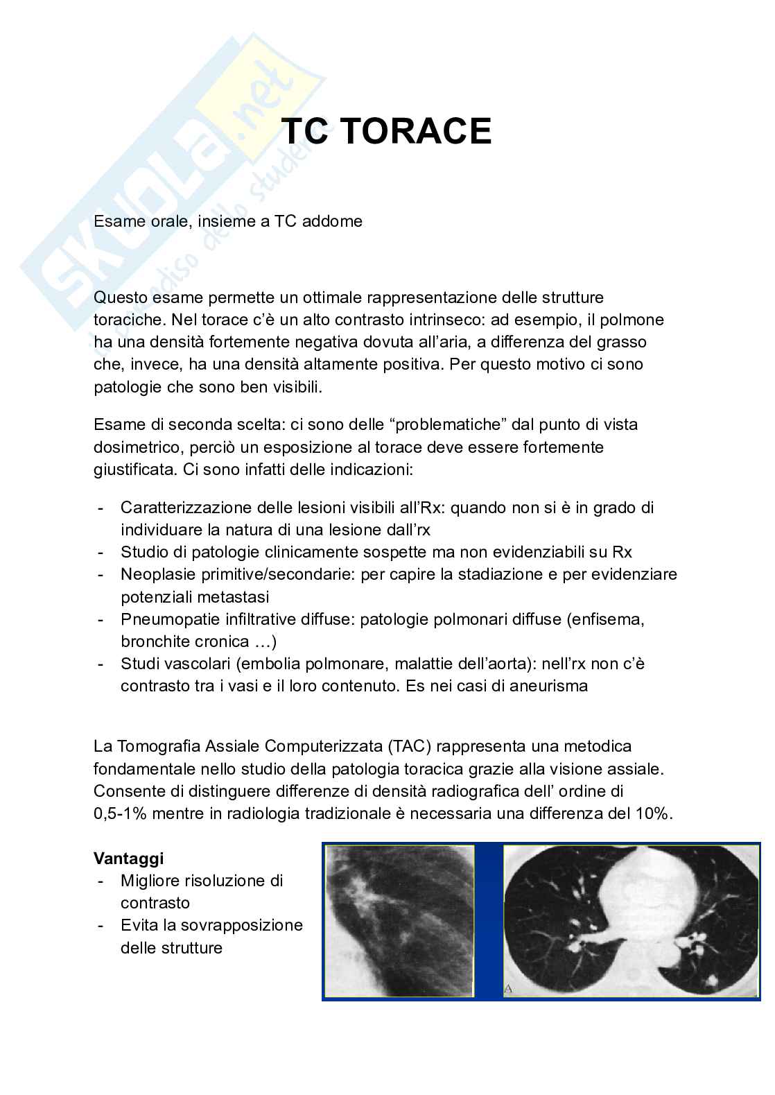 Riassunto esame Tc torace, Prof. Tosatti Giovanni, libro consigliato Manuale di diagnostica per immagini, Torricelli Pag. 1