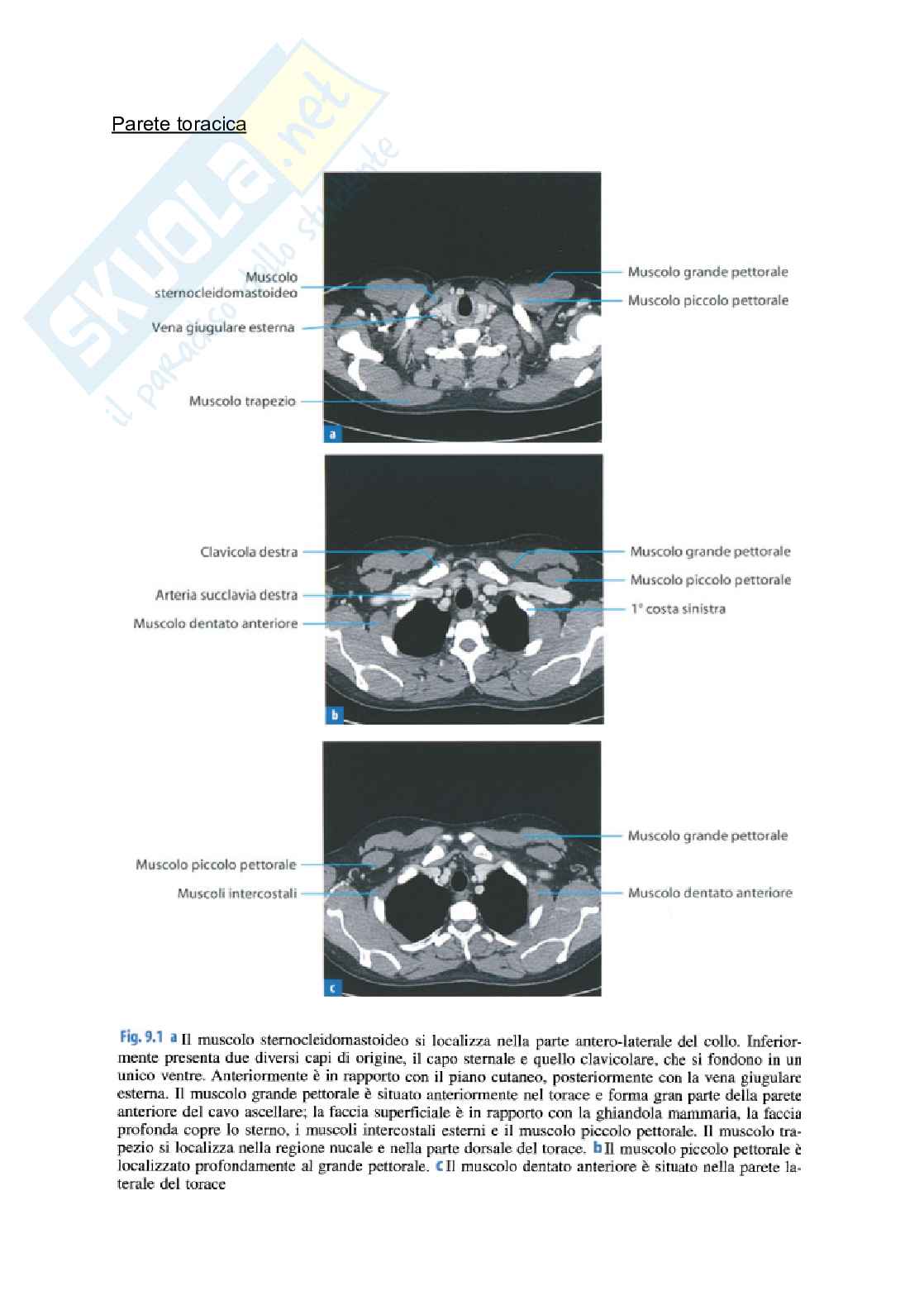 Riassunto esame Tc torace, Prof. Tosatti Giovanni, libro consigliato Manuale di diagnostica per immagini, Torricelli Pag. 11