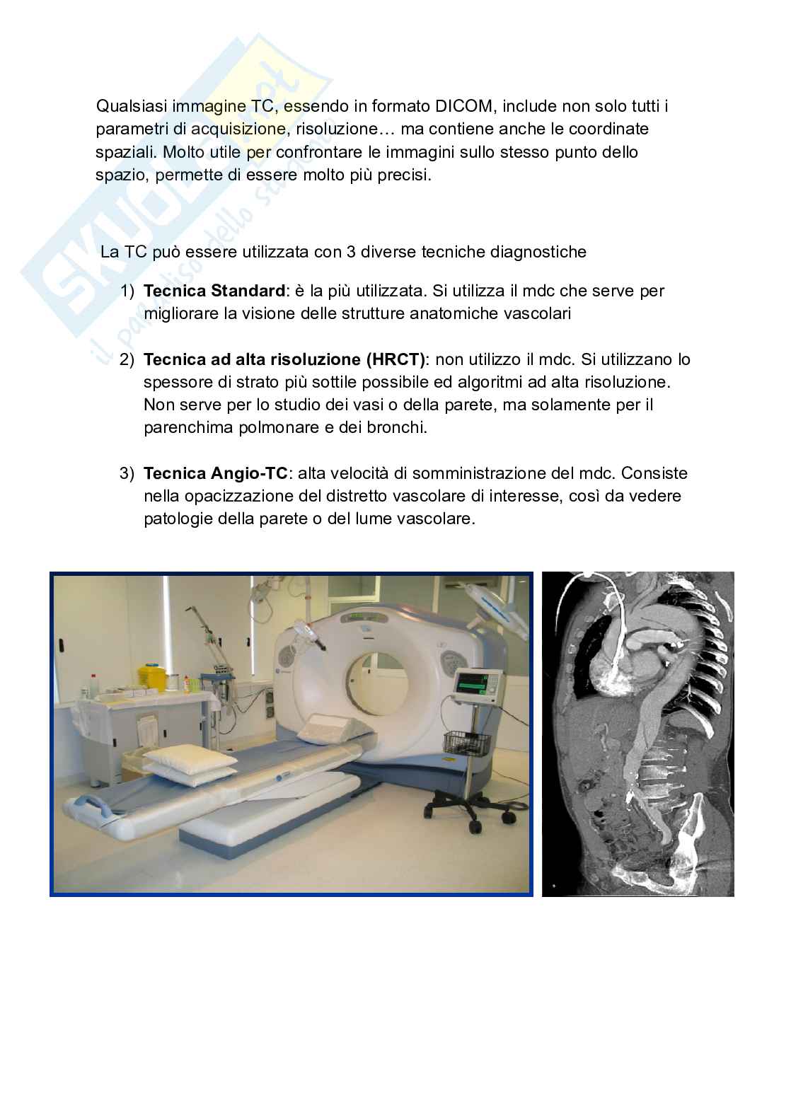 Riassunto esame Tc torace, Prof. Tosatti Giovanni, libro consigliato Manuale di diagnostica per immagini, Torricelli Pag. 2