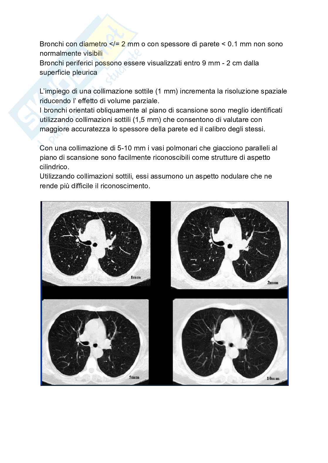 Riassunto esame Tc torace, Prof. Tosatti Giovanni, libro consigliato Manuale di diagnostica per immagini, Torricelli Pag. 21
