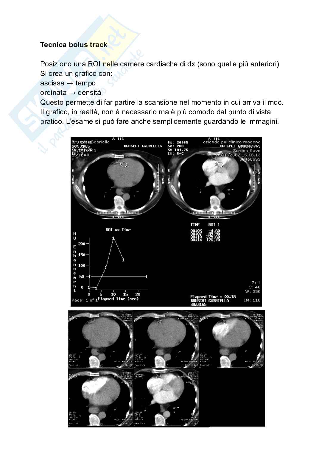 Riassunto esame Tc torace, Prof. Tosatti Giovanni, libro consigliato Manuale di diagnostica per immagini, Torricelli Pag. 26