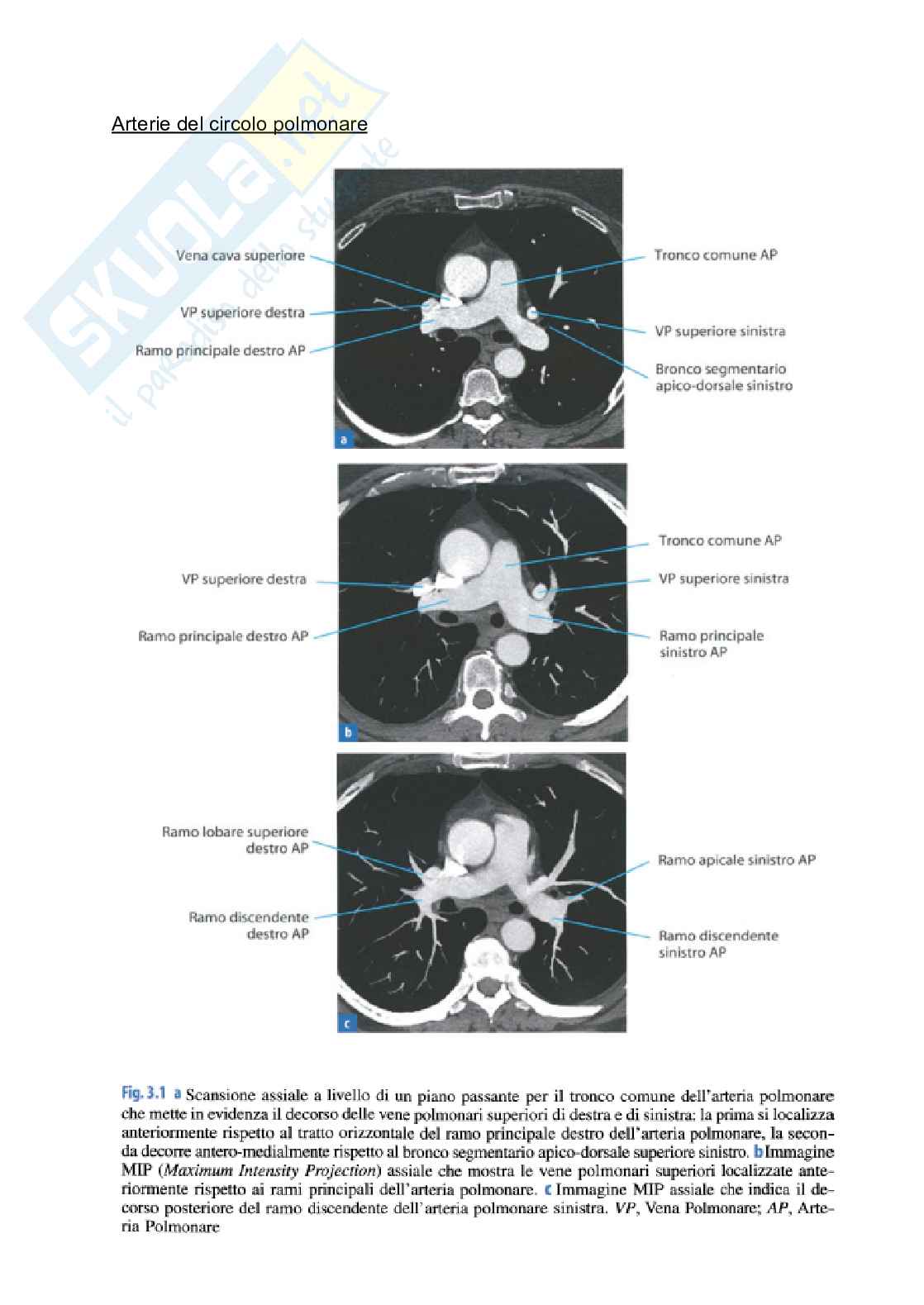Riassunto esame Tc torace, Prof. Tosatti Giovanni, libro consigliato Manuale di diagnostica per immagini, Torricelli Pag. 6