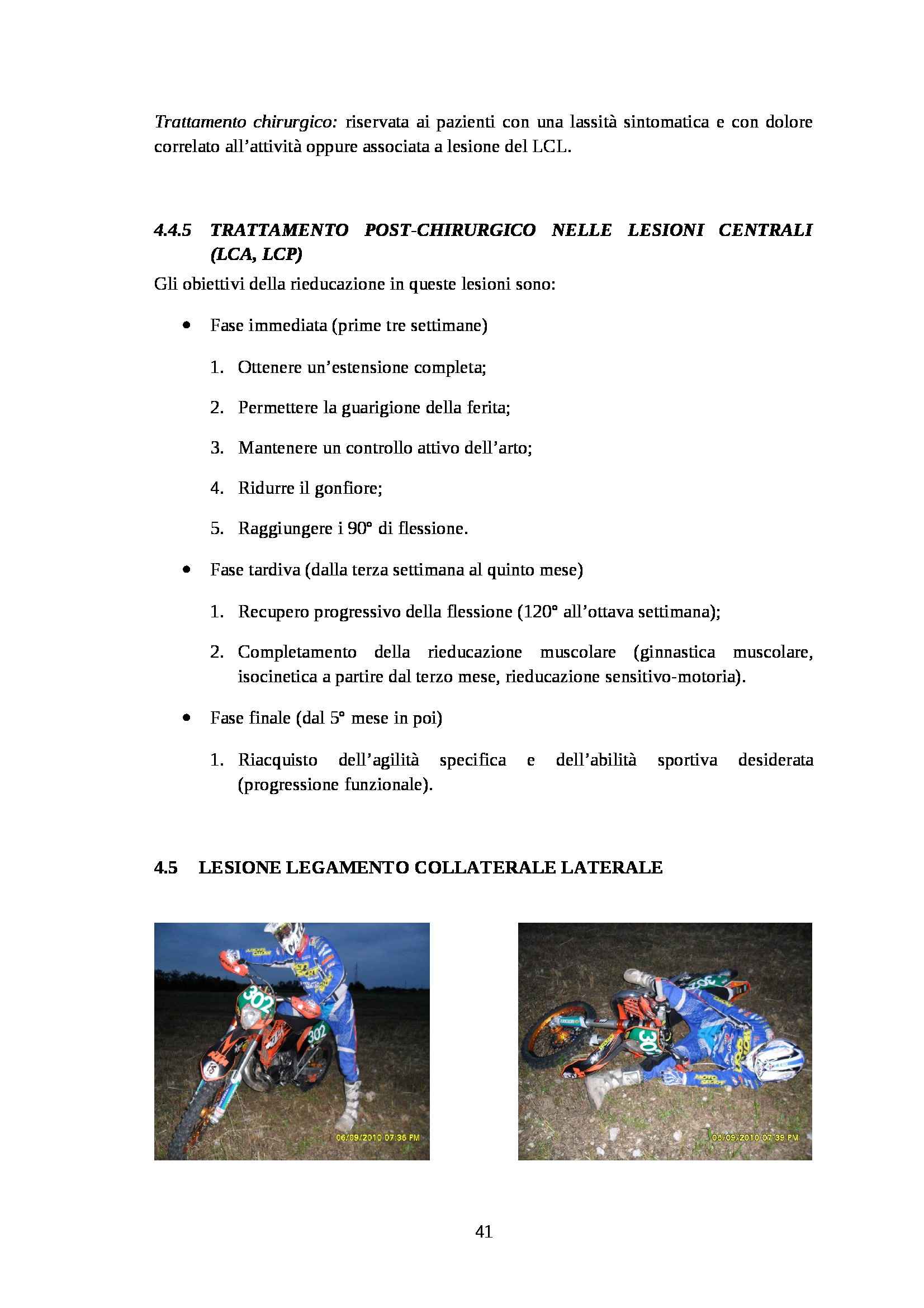 Tesi - Lesioni capsulo legamentose del ginocchio nella pratica del motocross Pag. 41