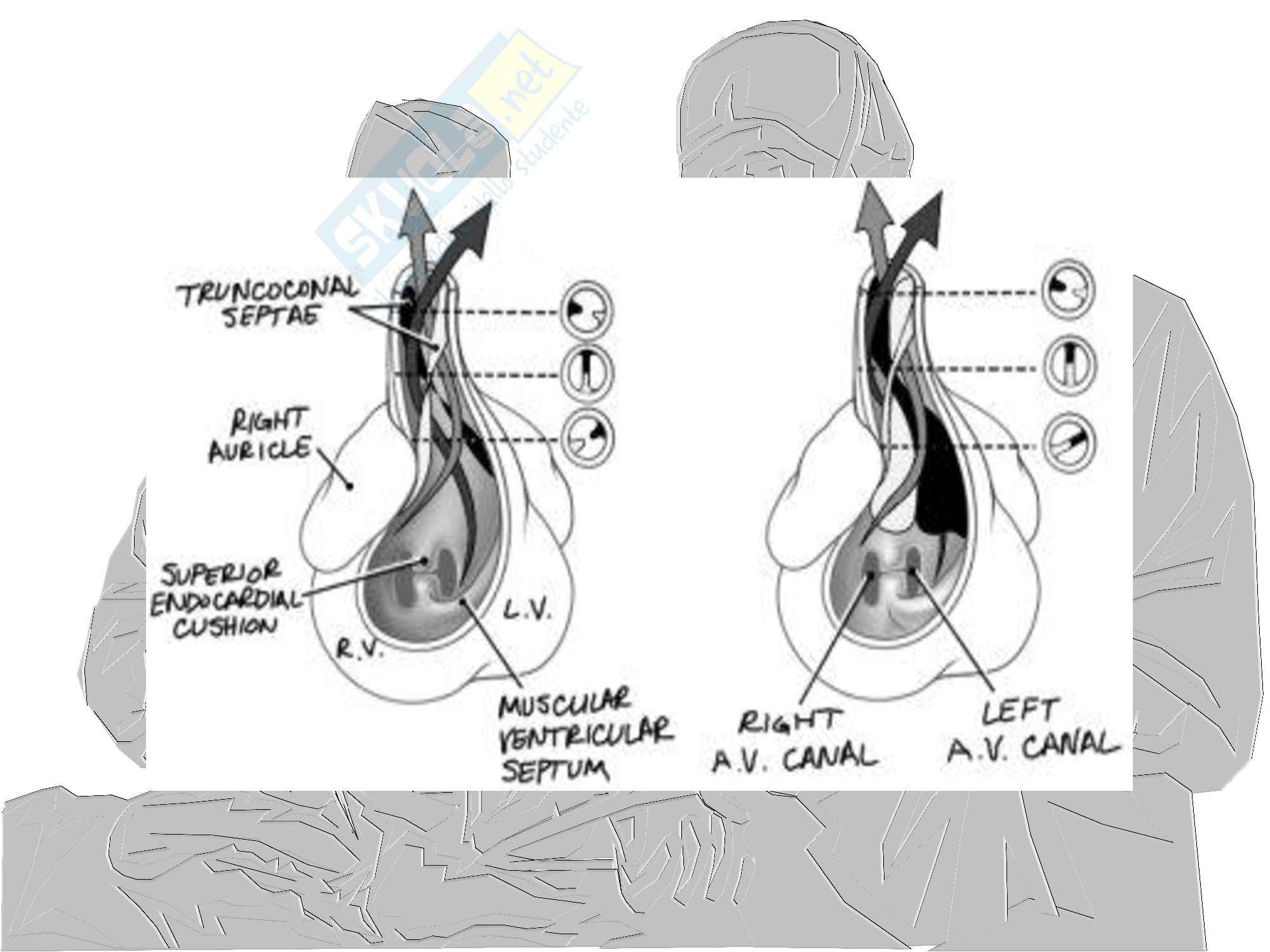 Cardiochirurgia - cardiopatie congenite Pag. 16