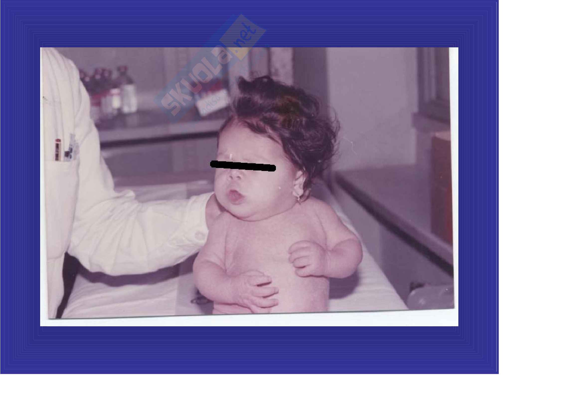 Scienze pediatriche mediche e chirurgiche - Ipotiroidismo Pag. 1