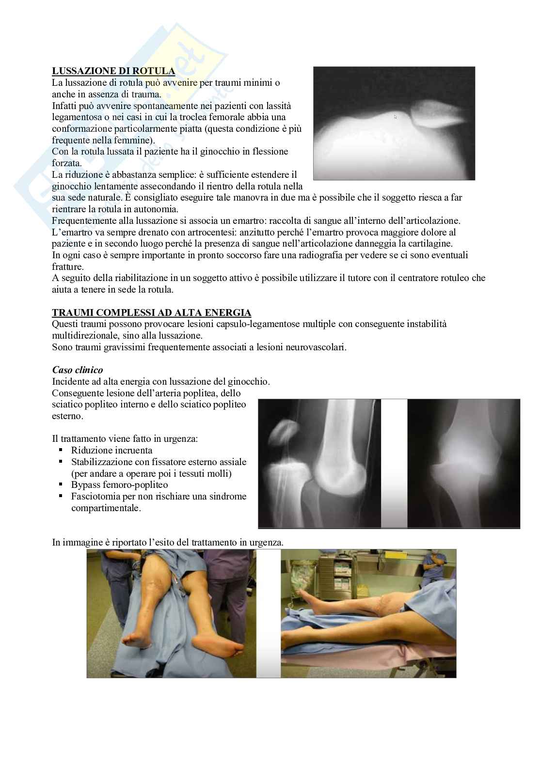 Fisioterapia - Appunti di ortopedia e traumatologia   Pag. 51