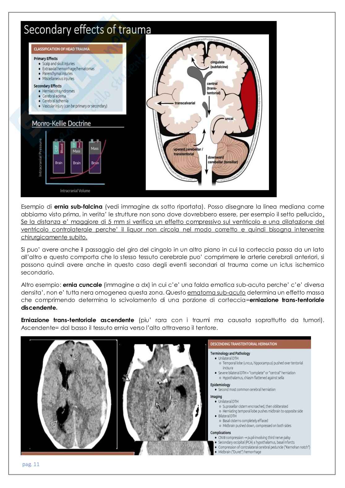 Neuroradiologia tc Pag. 11