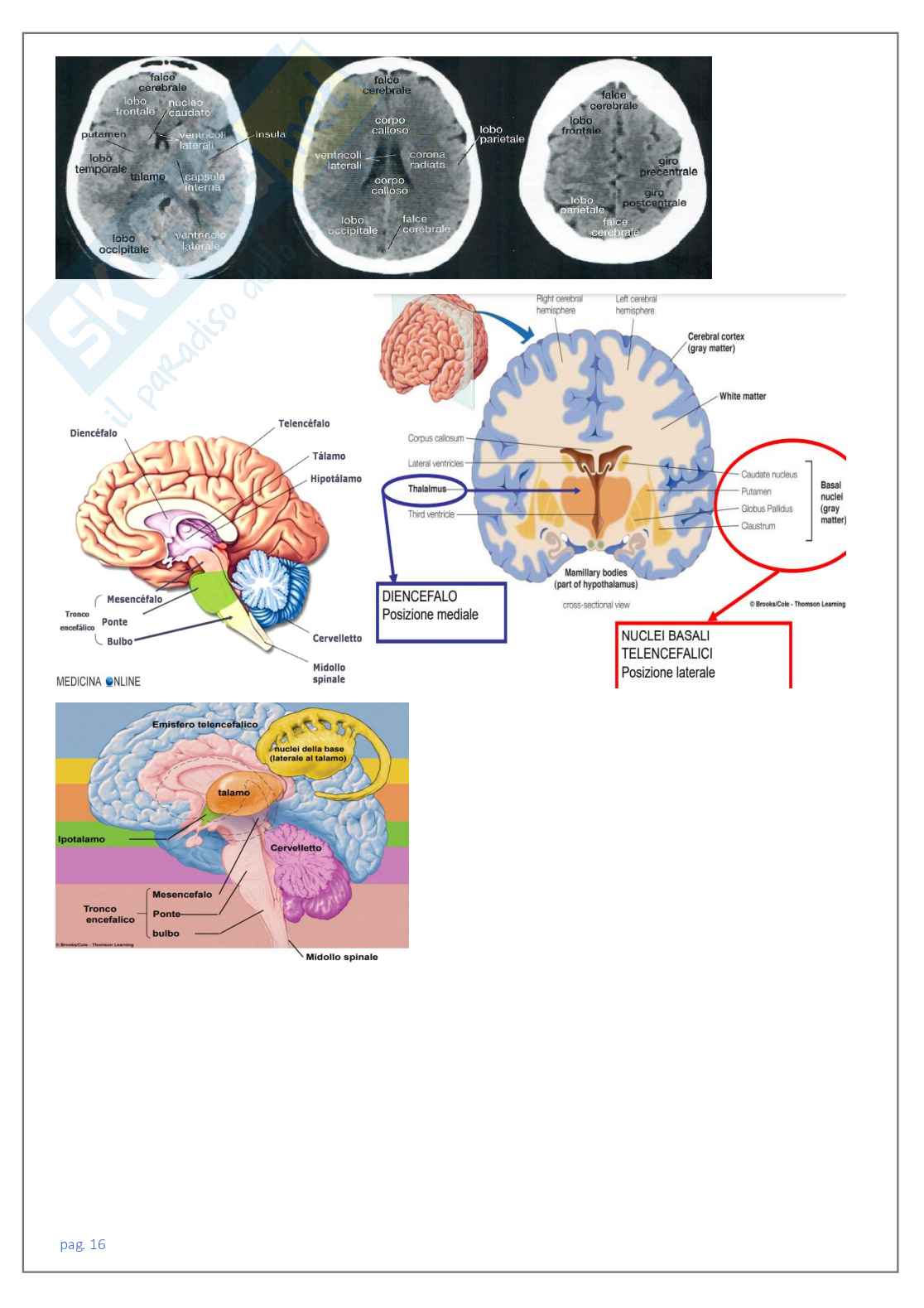 Neuroradiologia tc Pag. 16