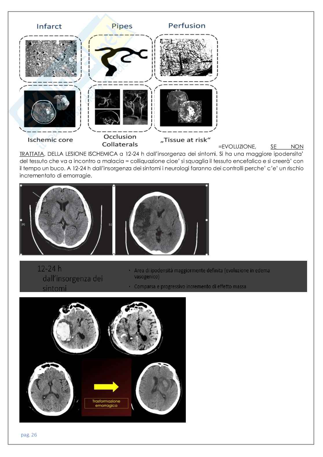 Neuroradiologia tc Pag. 26