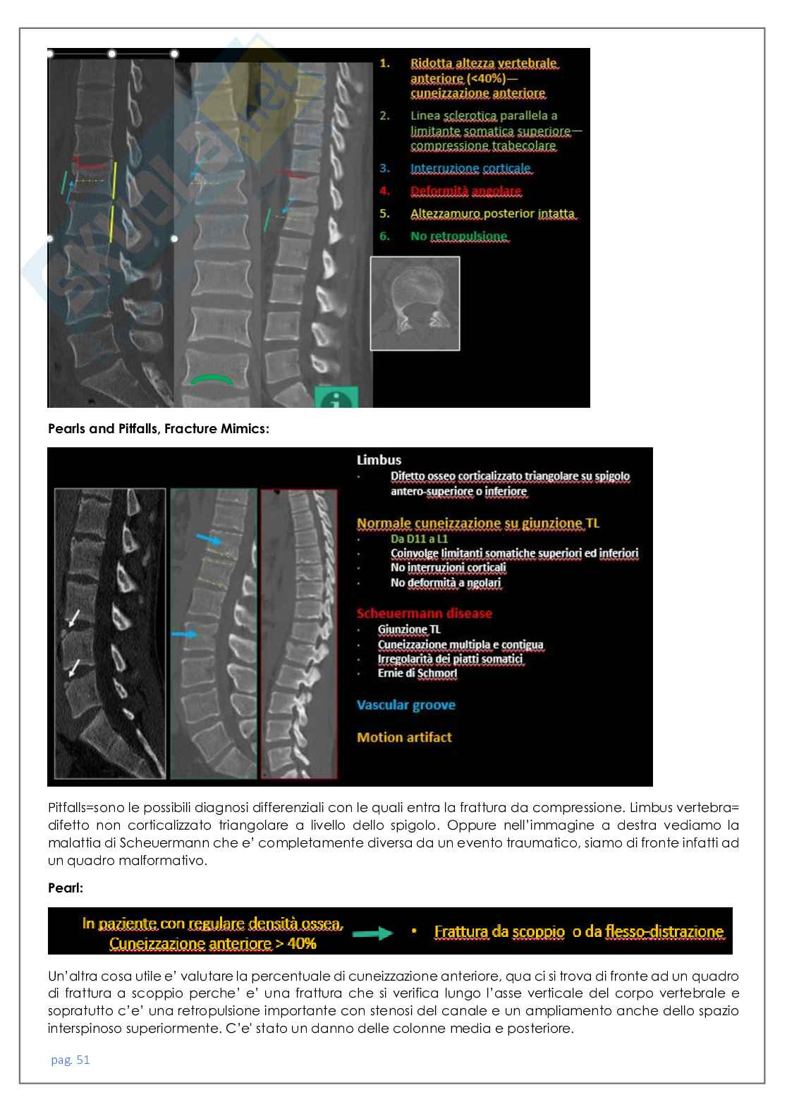 Neuroradiologia tc Pag. 51