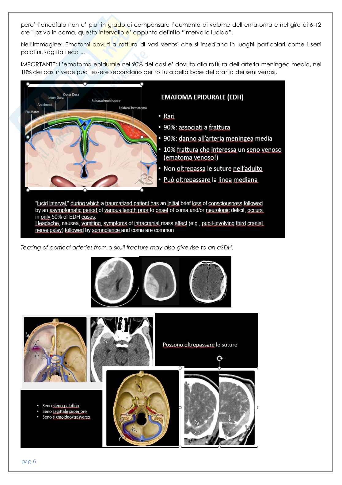 Neuroradiologia tc Pag. 6