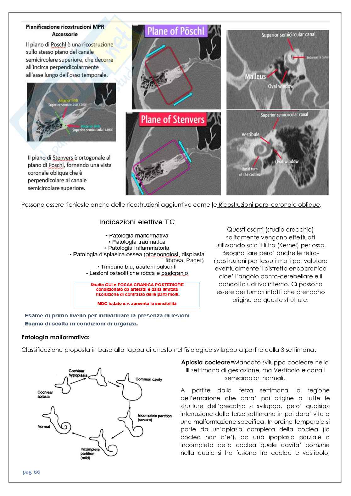 Neuroradiologia tc Pag. 66