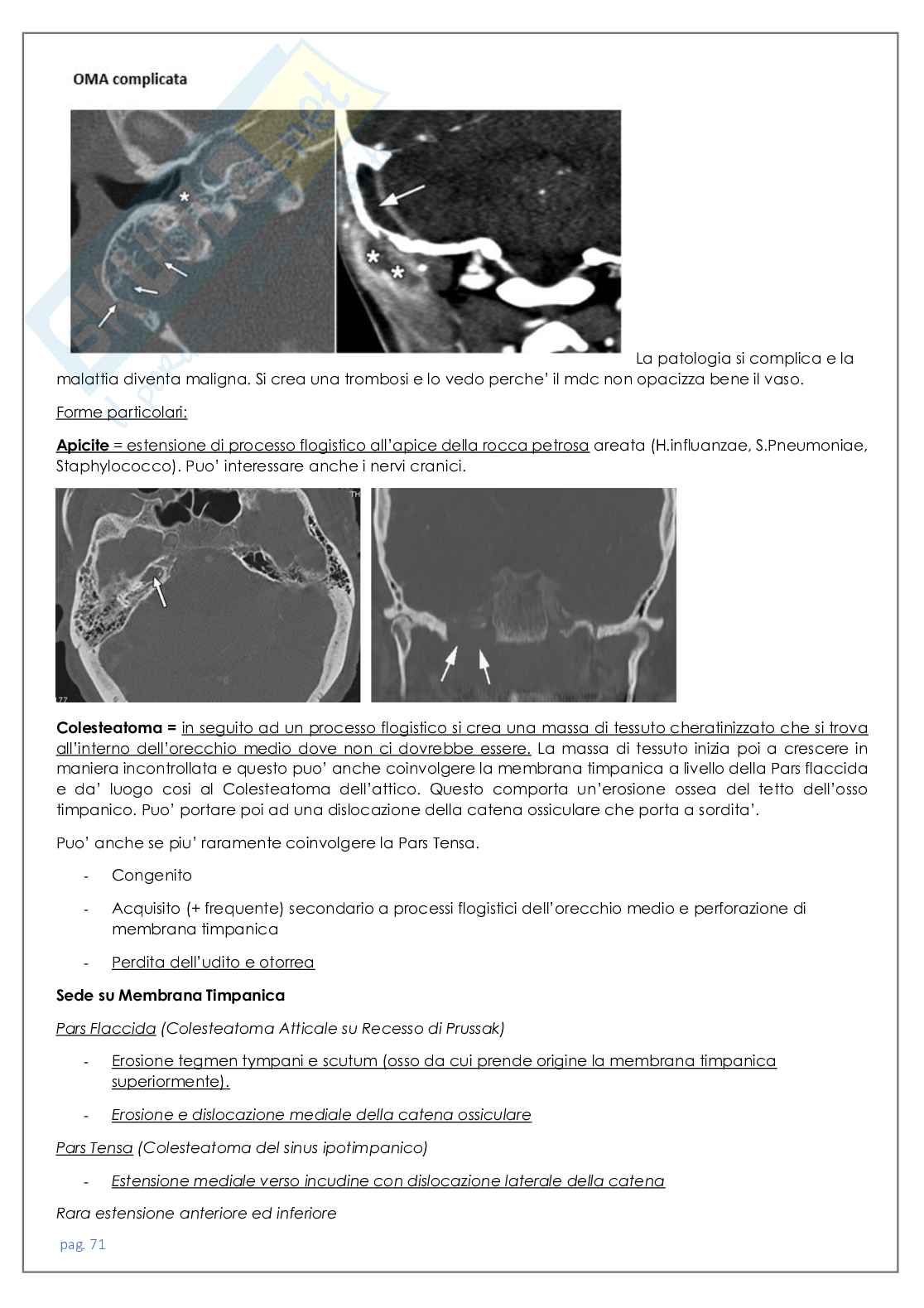 Neuroradiologia tc Pag. 71