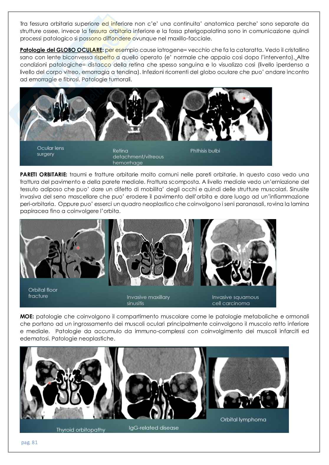 Neuroradiologia tc Pag. 81