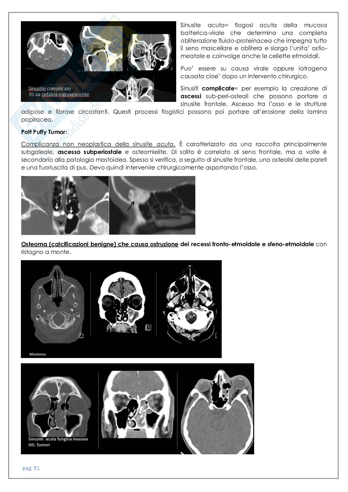 Neuroradiologia tc Pag. 91