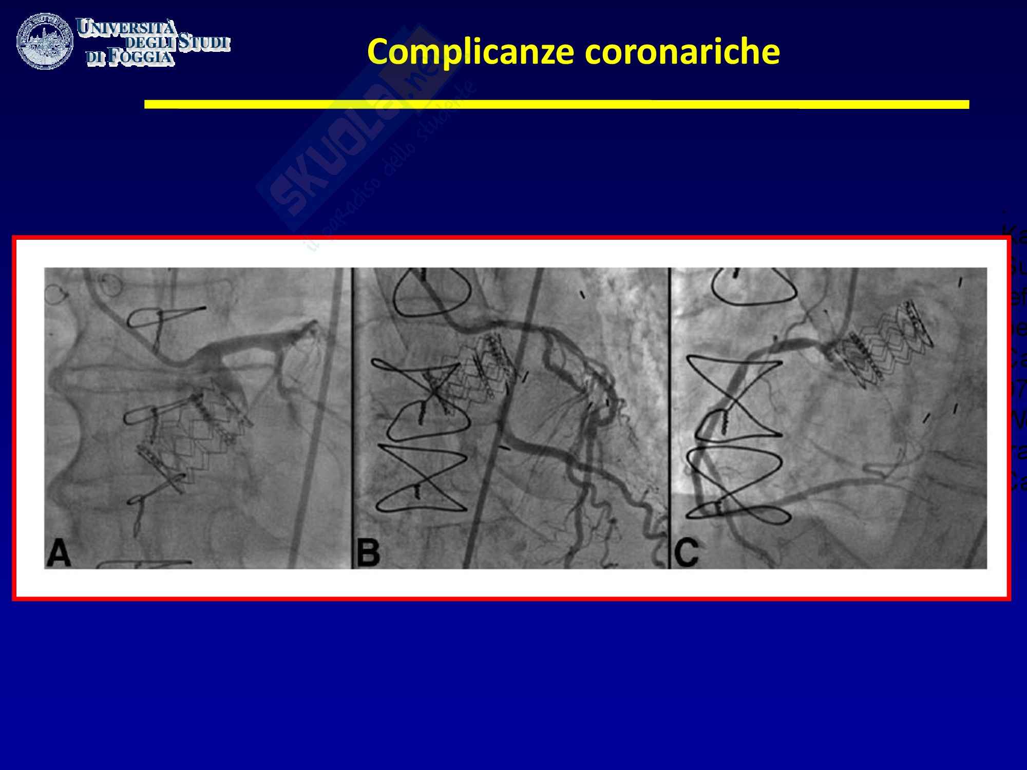Cardiologia - i registri TAVI Pag. 11