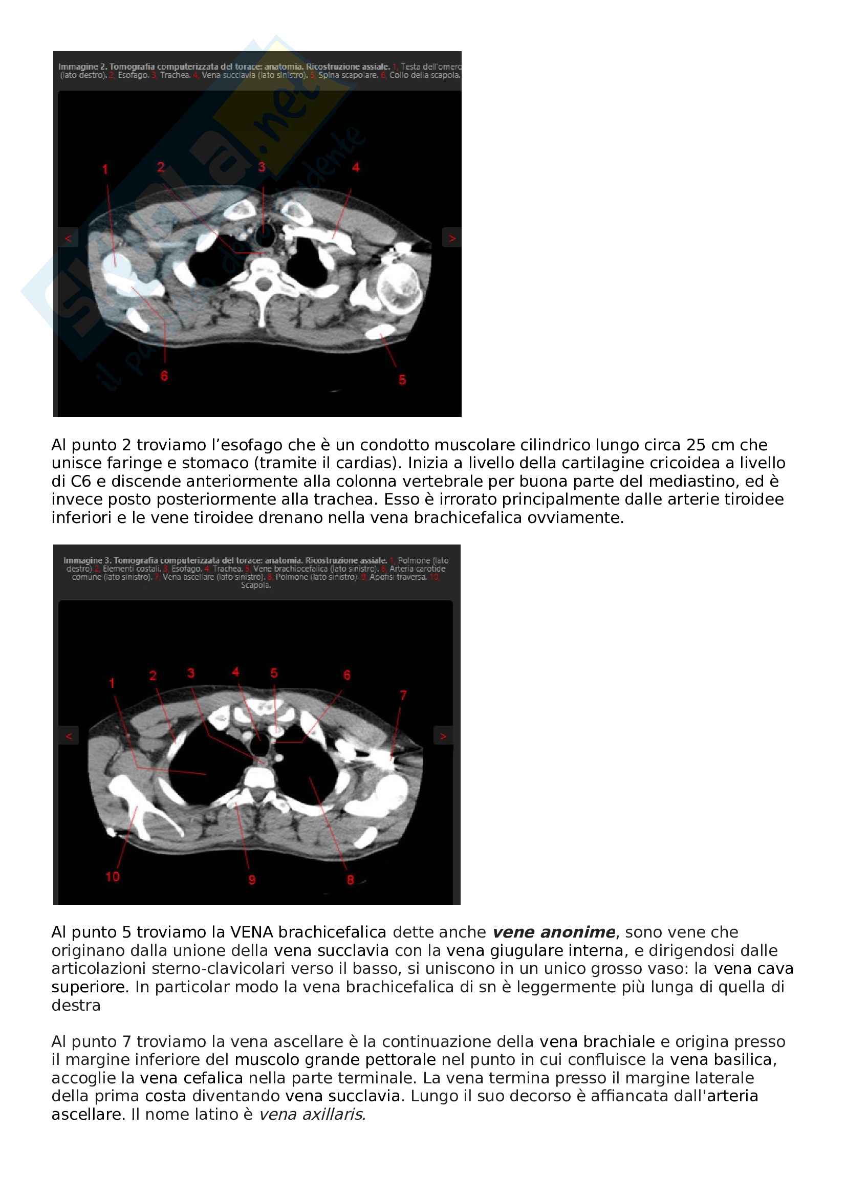 Tomografia Computerizzata (anatomia, apparecchiatura, mdc, infermieristica) Pag. 16