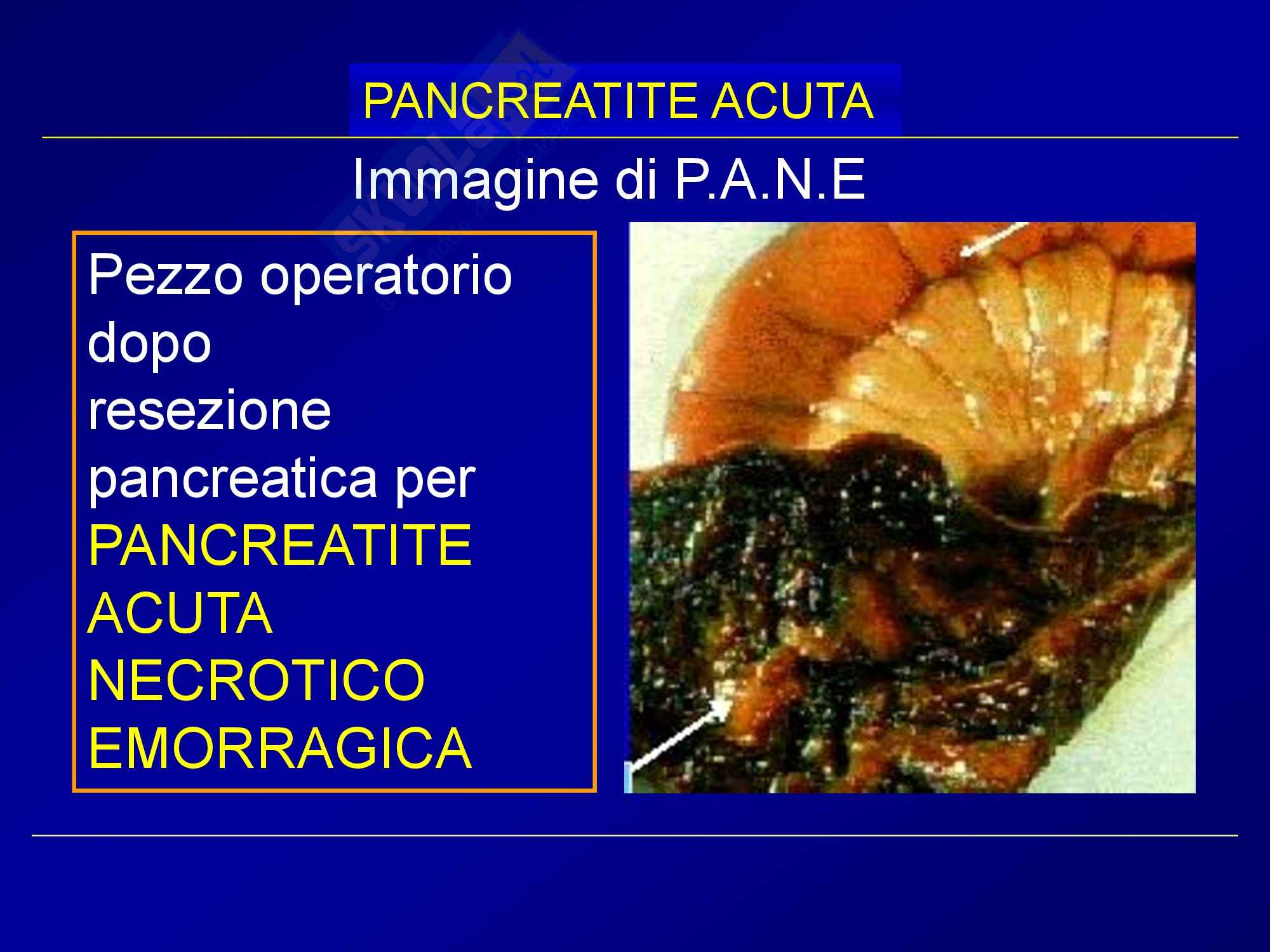 Pinza Hasson S Linvatec 118371 – Lama Larga 1/4, Usata Ma In Ottime Condizioni Per Chirurgia Generale - Foto 4