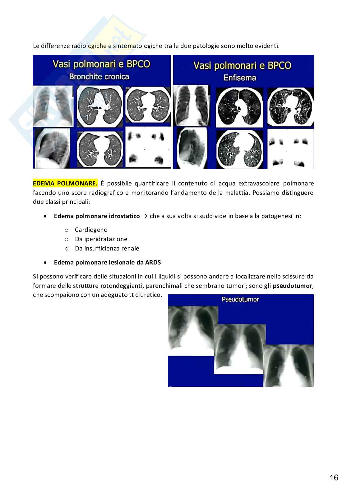 Pneumologia e chirurgia toracica Pag. 21