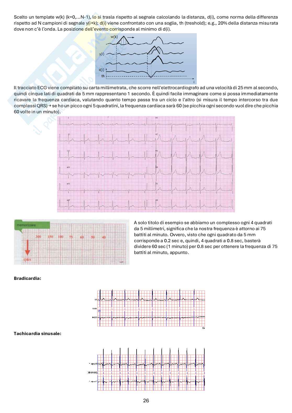 Appunti di Bioingegneria elettronica e informatica Pag. 26
