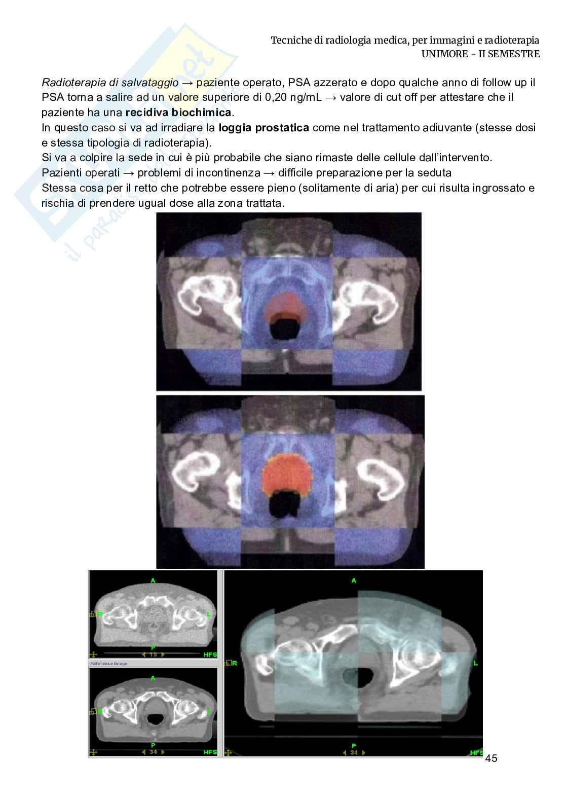 Radioterapia e radiobiologia Pag. 11