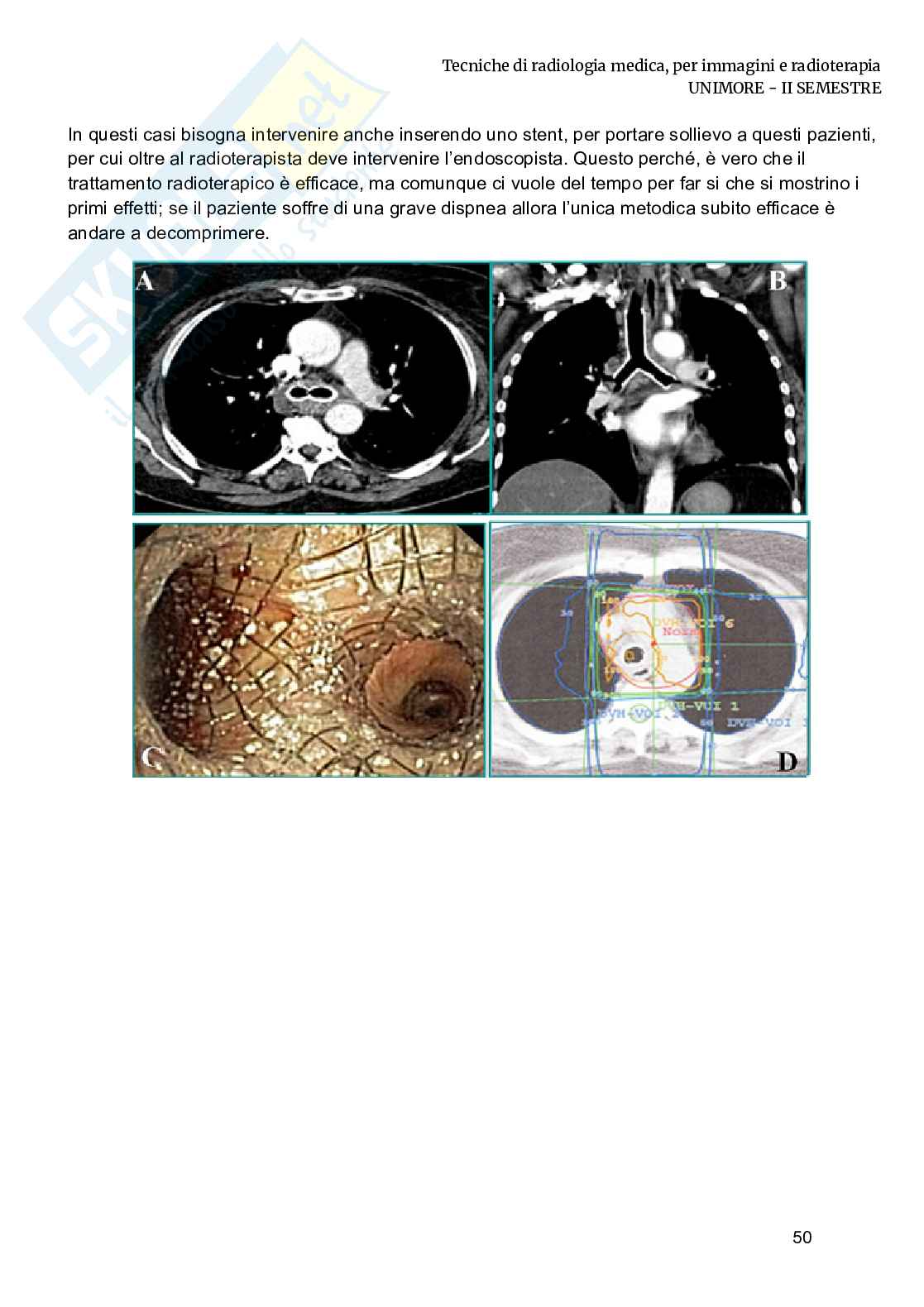 Radioterapia e radiobiologia Pag. 16