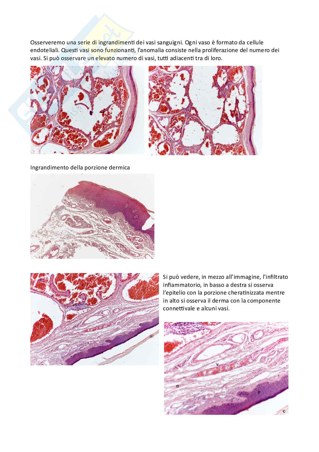 Vetrini Patologia generale Pag. 16